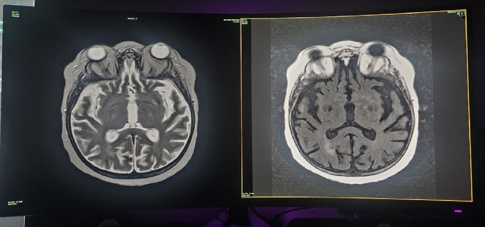NoustaView running in a true full-screen view on a curved monitor, showing two MRI brain panels with no browser chrome or toolbar visible at all