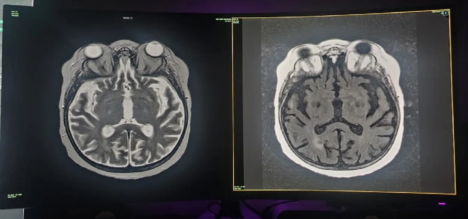 NoustaView running in a true full-screen view on a curved monitor, showing two MRI brain panels with no browser chrome or toolbar visible at all