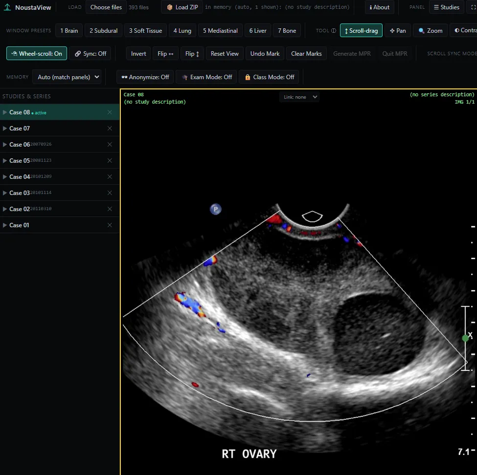 NoustaView showing a Doppler ultrasound study of the right ovary with color flow, and a sidebar listing eight loaded teaching cases